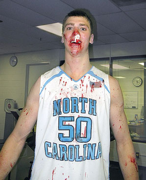 Where's Tyler Hansbrough? - Page 2 - RealGM